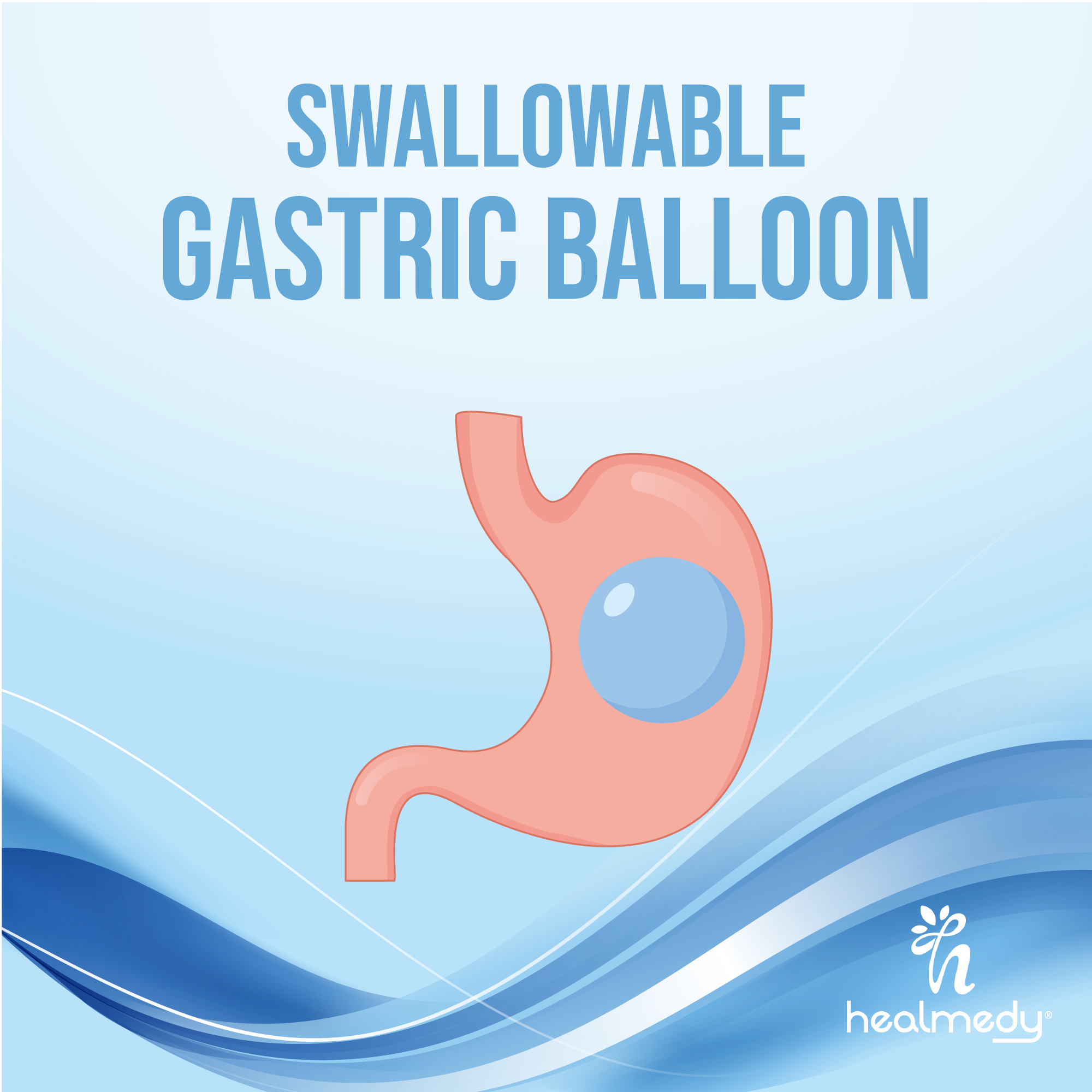 Swallowable Gastric Balloon - HEALTCARE CONSULTING SERVICES & SOLUTIONS