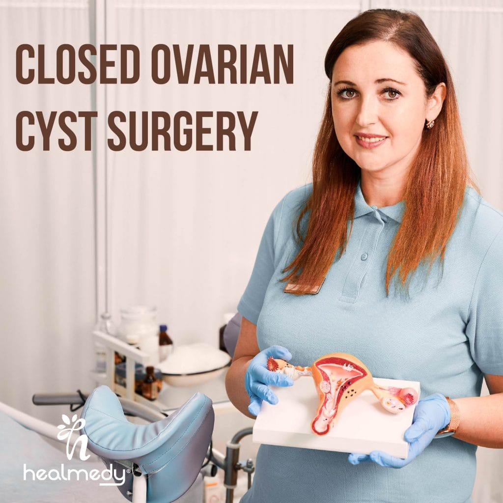 Closed Ovarian Cyst Surgery HEALTCARE CONSULTING SERVICES & SOLUTIONS
